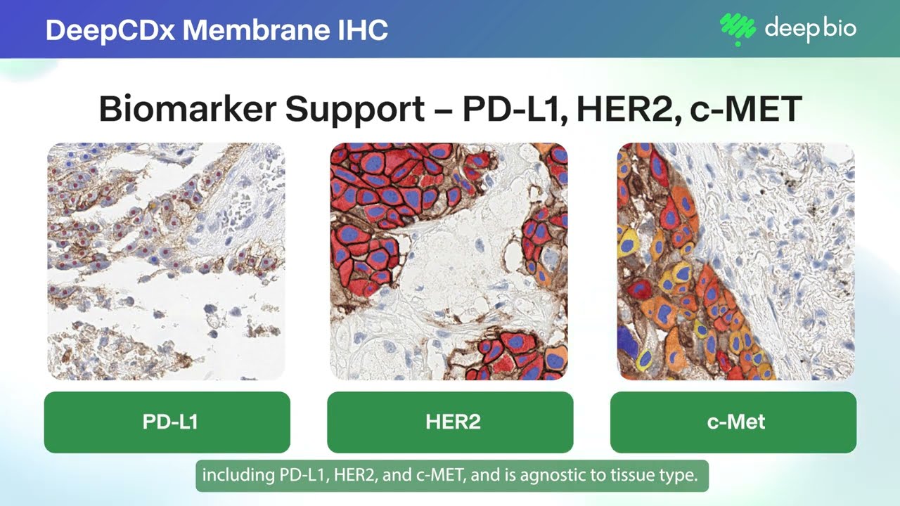 Introducing DeepCDx Membrane IHC