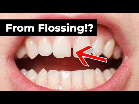 Flossing Causes Gaps?