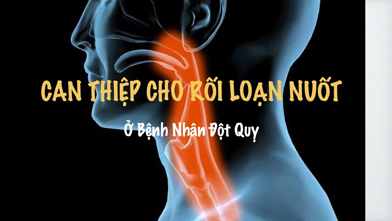 Can thiệp cho rối loạn nuốt ở bệnh nhân đột quỵ