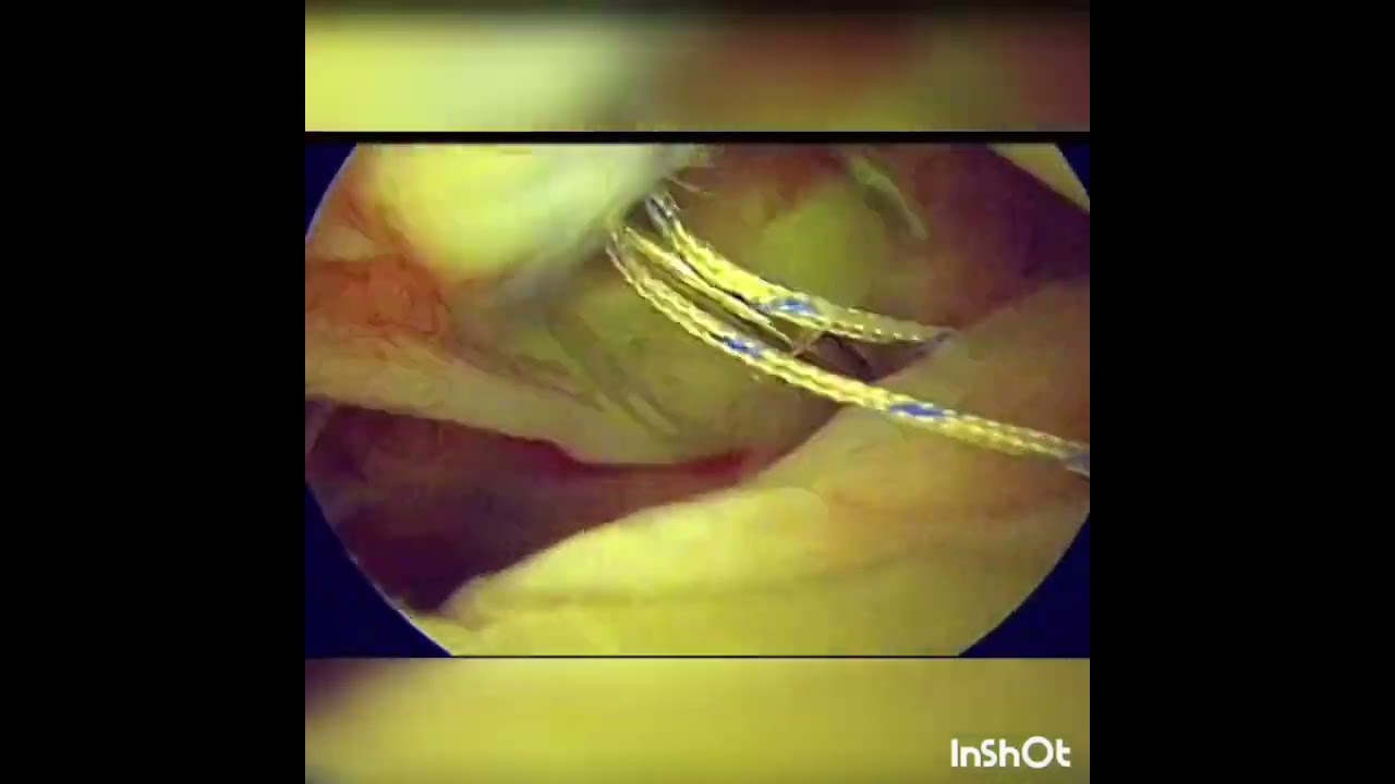 Jorge Luis Córdova Fonseca-11