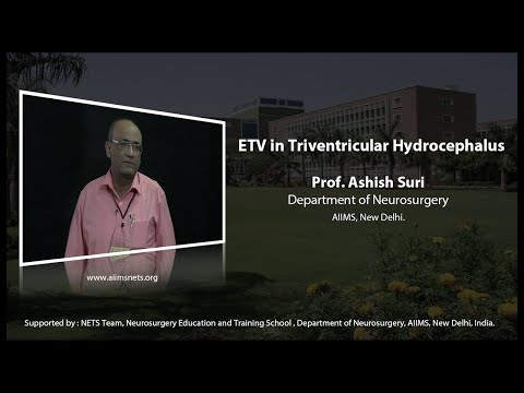 ETV in triventricular hydrocephalus