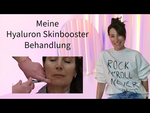 MEINE ERSTE HYALURON SKINBOOSTER BEHANDLUNG  💟 EINBLICKE & ERFAHRUNG