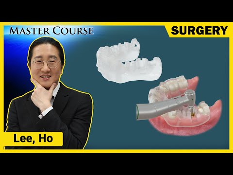 [Master Course Season2 - SURGERY] Digital Guided Implant Surgery