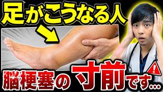 Download lagu 【突然倒れます…】知らないと後悔する『脳梗塞』の”足”の危険サイン５選【超意外な初期症状を医師解説】 mp3