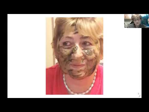 Nagy Ágnes Lamiderm Apex+ Omnia arcpakolás tapasztalatai