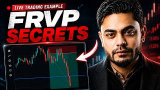 How to Use FRVP in Live Trading?