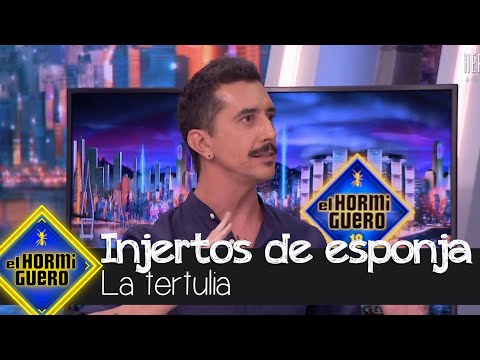 Marron propone un remedio infalible para la alopecia: Injertos de esponja - El Hormiguero
