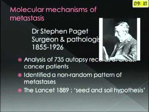 benign bone tumours- An Overview