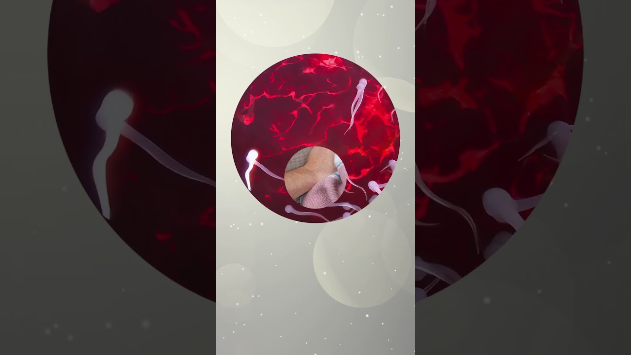 Different Types Of Male Infertility | Infertility Treatment | Stem Cell Therapy For Infertility