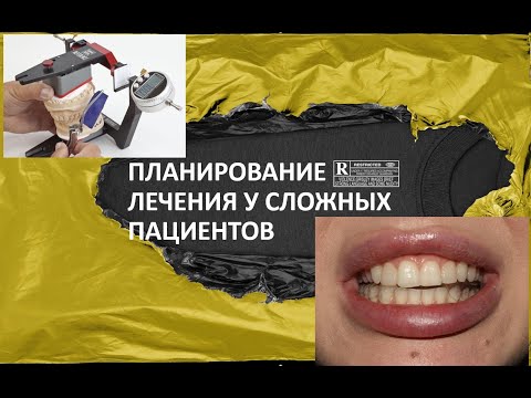 Планирование лечения у сложных пациентов