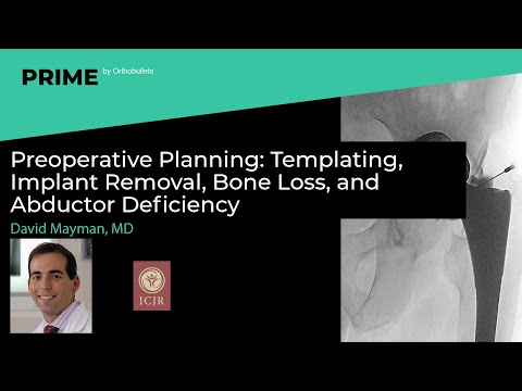 Pre-op Planning: Templating, Implant Removal, Bone Loss, and Abductor Deficiency - David Mayman, MD