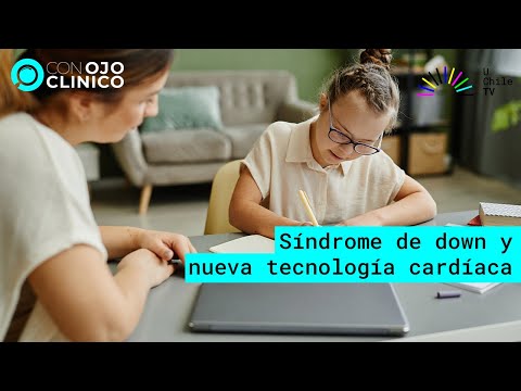 Con Ojo Clínico - CAP 61: Síndrome de down y nueva tecnología cardíaca