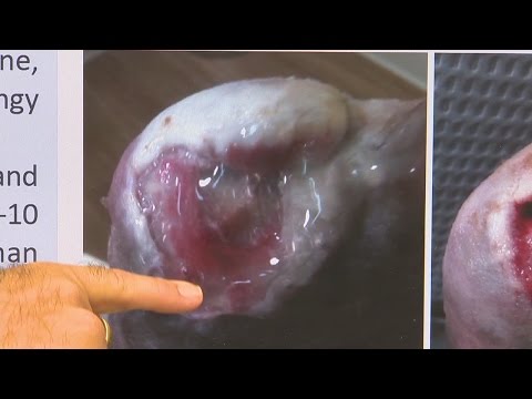 Placenta extract gel (placentrex gel)