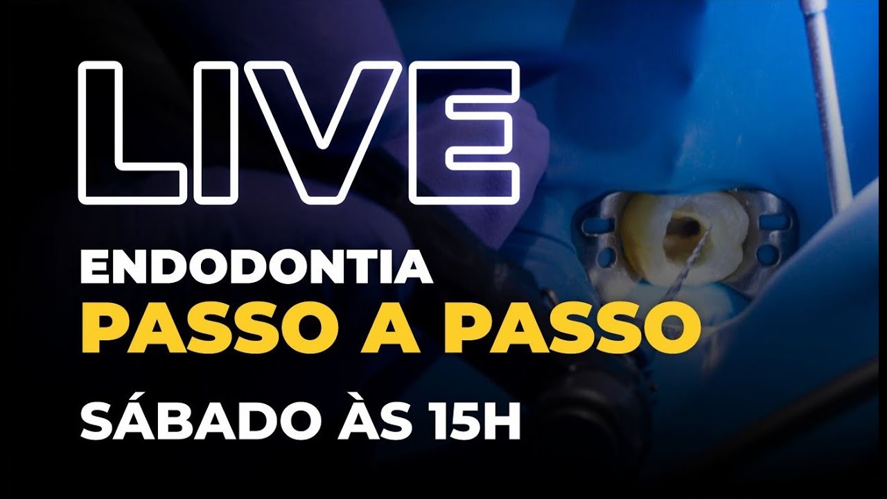 LIVE #097 - Endodontia Passo a passo completo