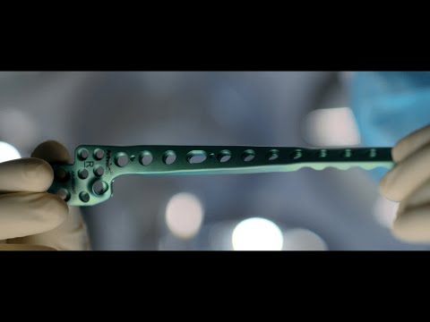 Arthrex Pilon Fusion System