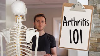What Exactly is Arthritis? | Physiotherapist Explains Osteoarthritis