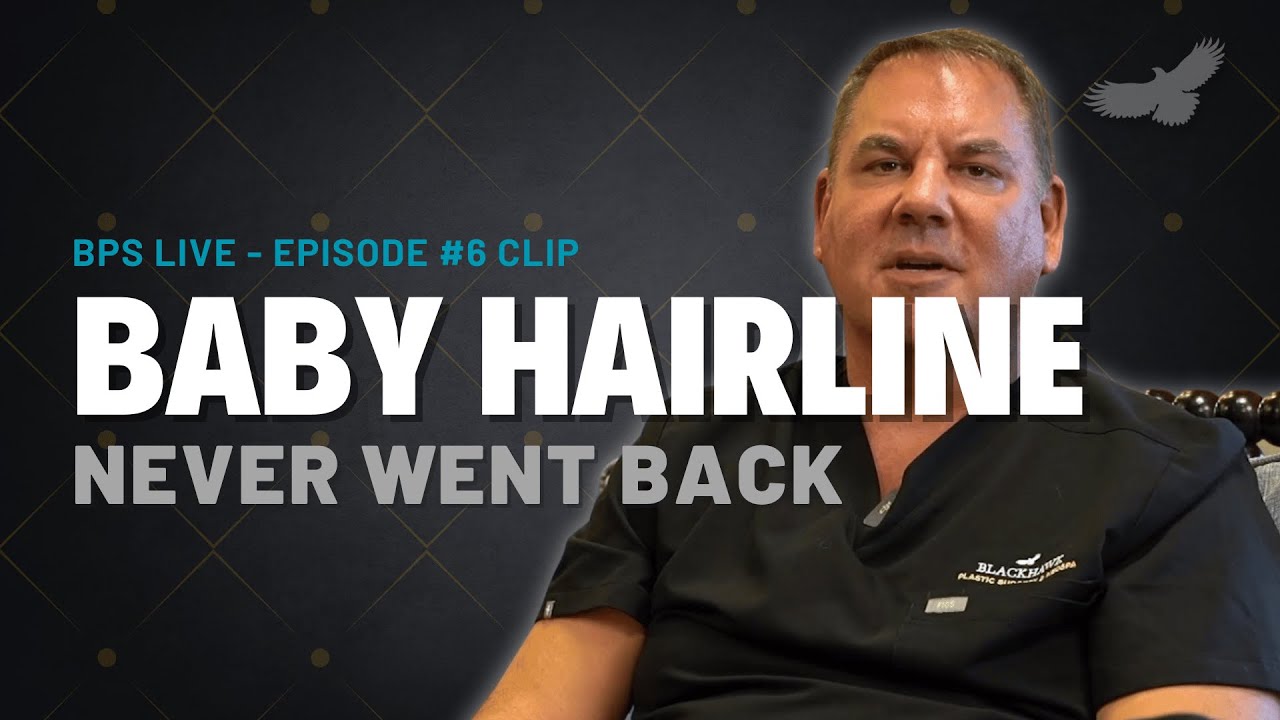 Is It the Right Time for a Hair Transplant? Expert Advice from Dr. Ronan & Adriane McDonald