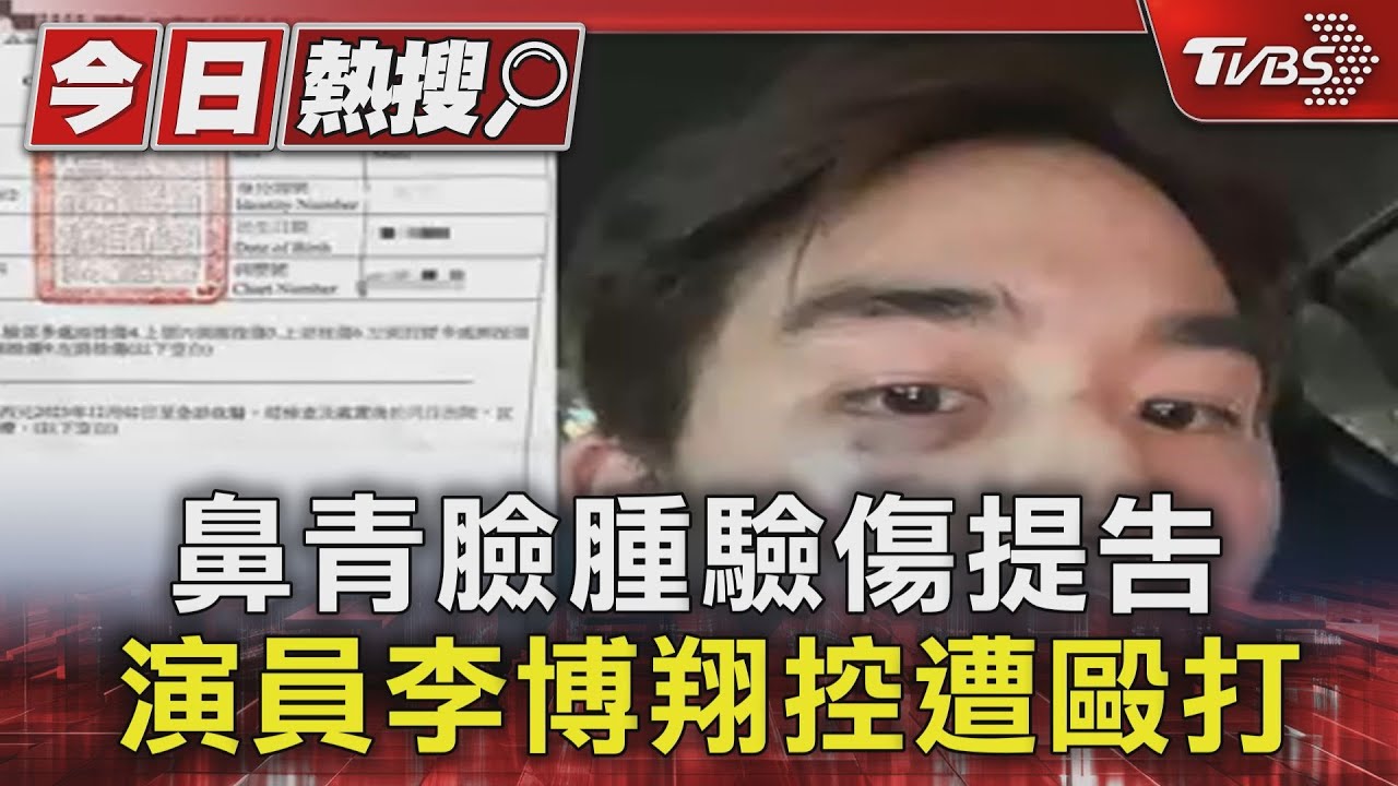 鼻青臉腫驗傷提告 演員李博翔控遭毆打