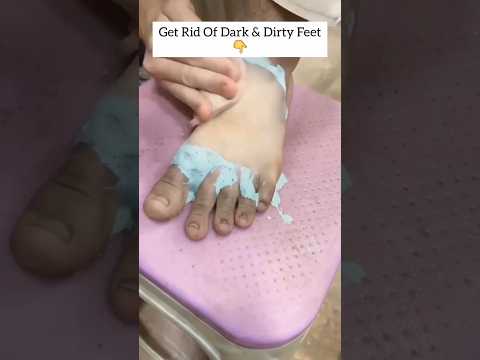 🔥Get Rid Of Dark & Dirty Feet | Remove Sun Tan Easily At Home ✅ #shorts #youtubeshorts