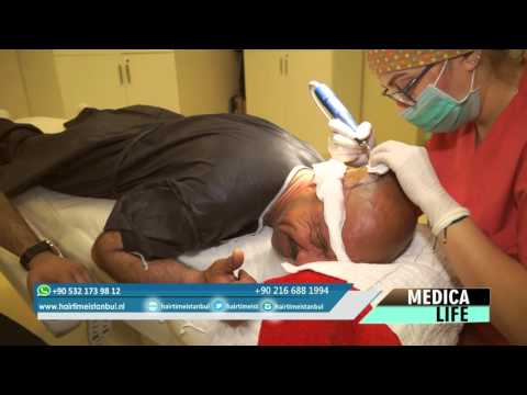 Genel Koordinatör, Hairtimeistanbul'un hizmetlerini anlatıyor