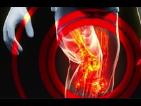 OSTEOARTHRITIS: A Condition That Makes Everyday Tasks a Struggle