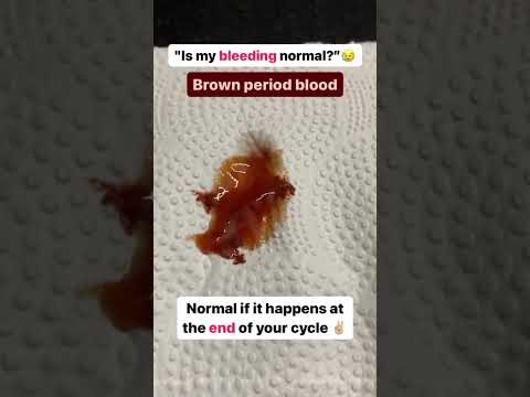 Is Your Bleeding Normal? Understanding Different Types of Bleeding