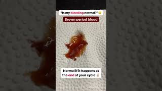 Is Your Bleeding Normal? Understanding Different Types of Bleeding