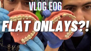The Posterior Onlay Course | IT WORKS! | ACE Diploma journey E06