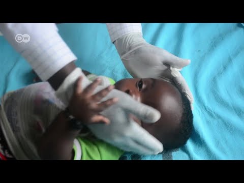 Kufinyanga vichwa vya watoto