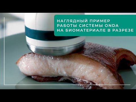 Наглядный пример работы системы ONDA на биоматериале в разрезе