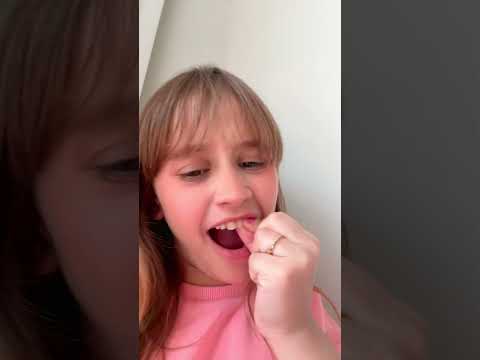 Meu dente tava mole 😭🫠