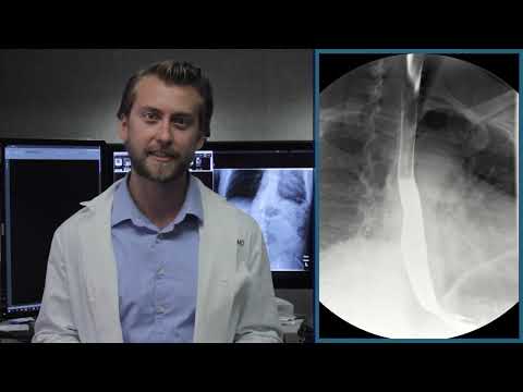Upper GI Series Patient Education Video