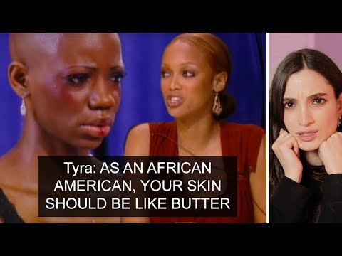 Tyra SHAMES Model For Her Skin Texture - Photographer Reacts