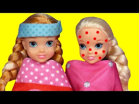 Toddler is SICK ! Elsa & Anna - CHICKENPOX - The other PRETENDS ? Who's really sick ? Doctor Barbie