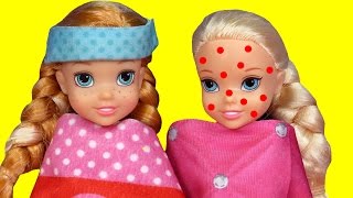 Toddler is SICK ! Elsa &amp; Anna - CHICKENPOX - The other PRETENDS ? Who&#39;s really sick ? Doctor Barbie