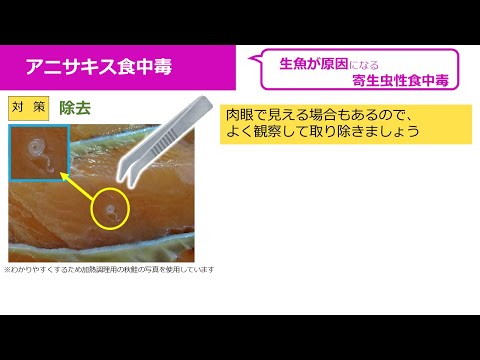 食中毒啓発ファイル Ｆｉｌｅ1 アニサキス食中毒