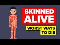 Skinned Alive - Worst Ways to Die