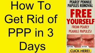 How To Get Rid of PPP in 3 Days