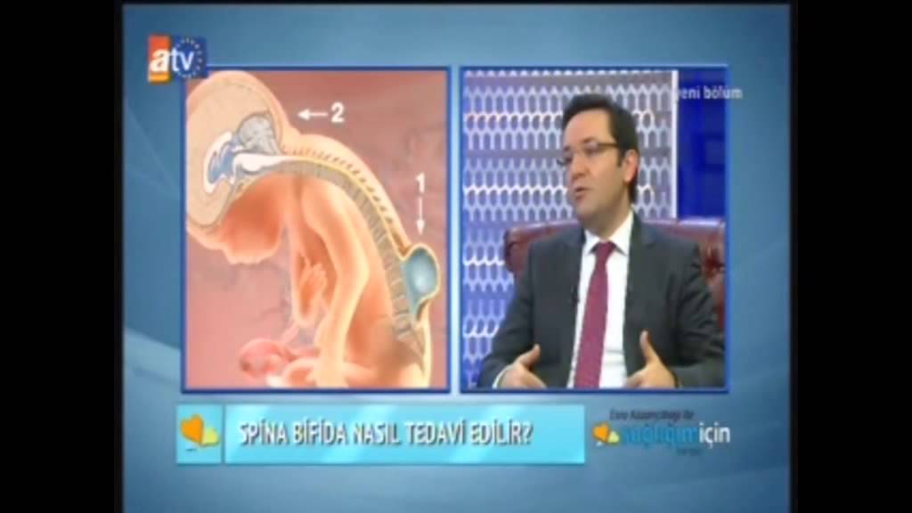Çocuklarda Açık Omurga Hastalığı (Spina Bifida)
