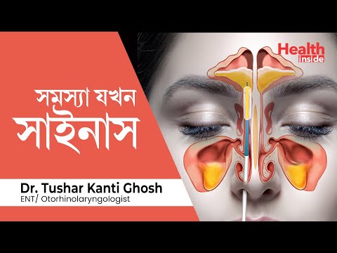 সাইনাস কি, সাইনাস কেন হয় এবং সাইনাসের ঘরোয়া চিকিৎসা | What is sinus? sinus home remedy in Bengali