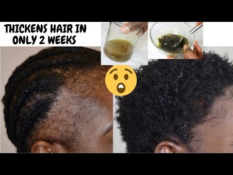 I Didn’t Expect These 2 Ways To Use Fenugreek To Grow My Hair Like This! Grows And Thicken Hair Fast