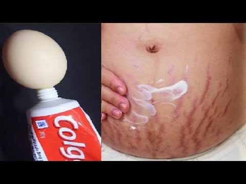 Eddagala Lya Mugaba Abali Ebweru