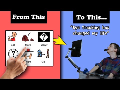 The Evolution of AAC