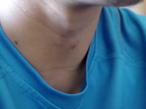 Epsilon(live freestyle)