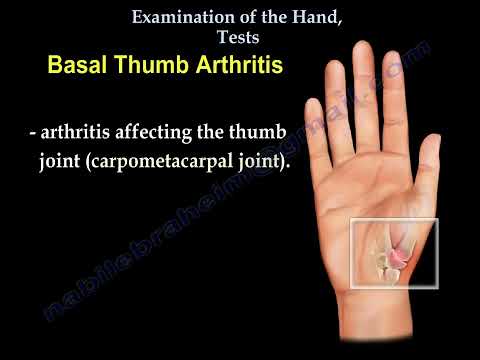 Examen de la mano y prueba del síndrome del túnel carpiano