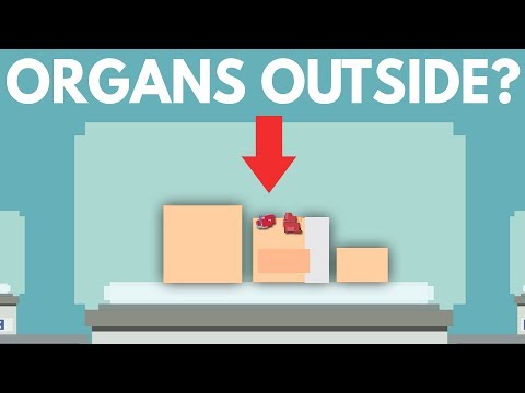 如果你的內臟長在身體外會怎麼樣？ (What Happens When Organs Grow Outside Your Body?)