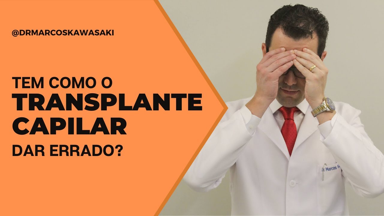 Tem como o transplante capilar dar errado?