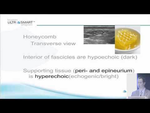 Terason's MSK Ultrasound Basics with Dr. Visco: Part 8 of 8