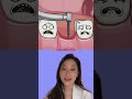 What Happens If You Lose A Tooth From Too Much Cavity Implant
