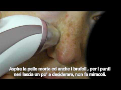Ringiovanimento di faccia in 50 anni I cerchi neri sotto occhi come liberarsi il video